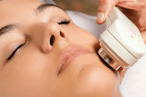 woman getting Dermafuse for acne, Rasaderm skincare
