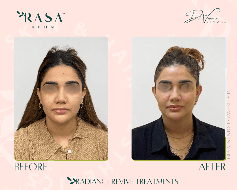 BEFORE AFTER BOOSTERS (1)