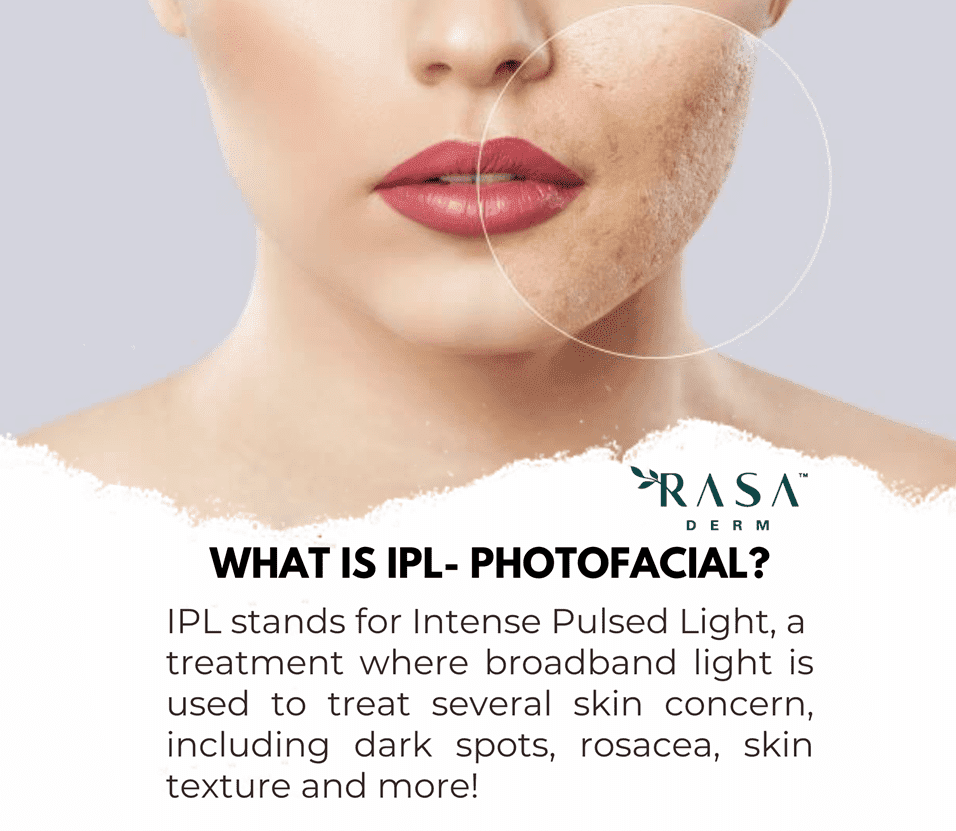 IPL-photofacial