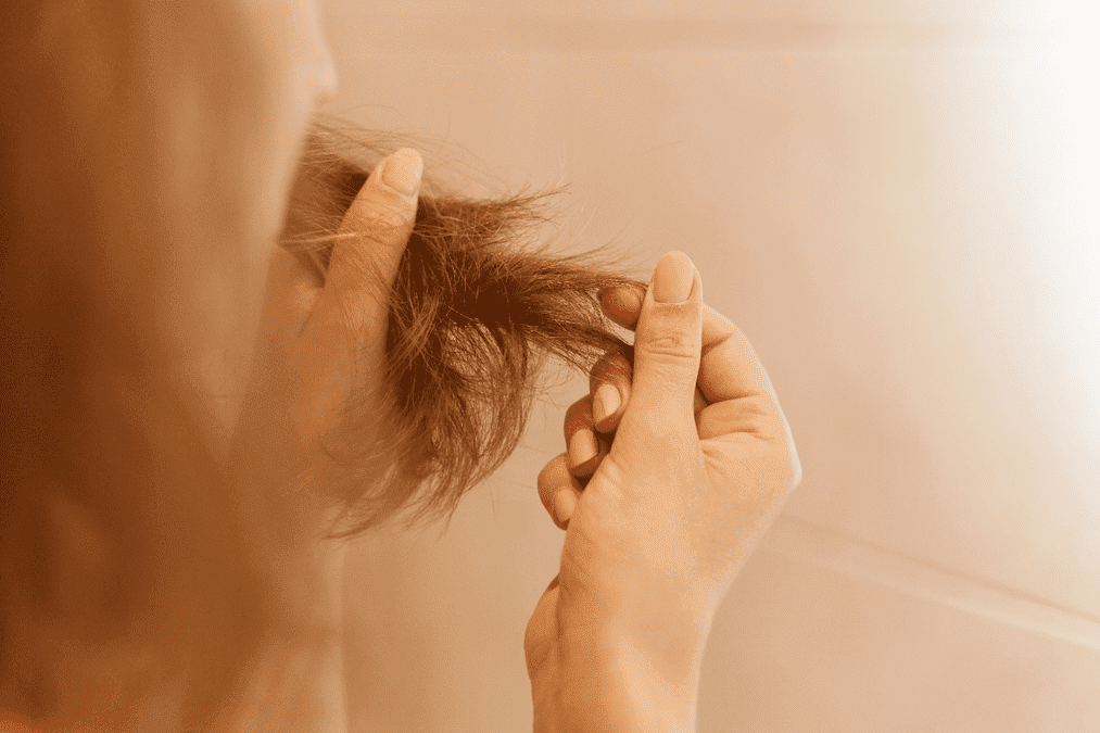 Covid-related hair loss by rasaderm
