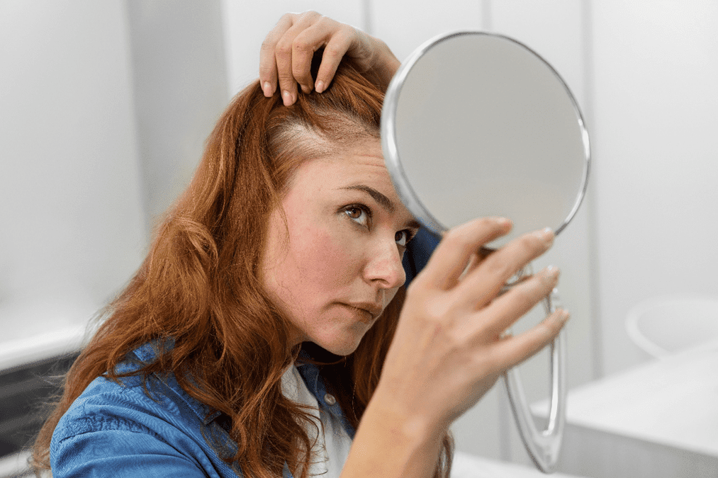 facing more hair loss by rasaderm