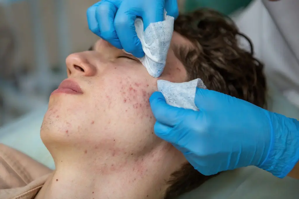 Laser Scar Removal